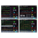 Monitor Multiparamétrico 8" EV-MM8 Vet