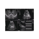 Ultrassom Portátil 12,1" EV-UT2 Vet