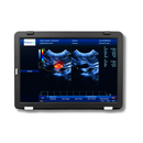 Ultrassom Portátil 15" EV-US4 Color Vet